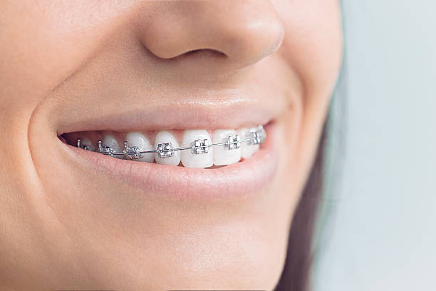 Why Choose Us for Your Dental Needs in Wilmore, KY